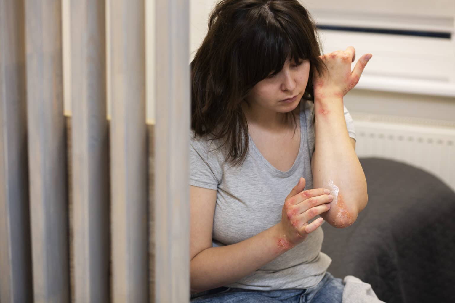 Oxycodone Rash Oxycodone Itching: What You Need to Know and How to Manage It